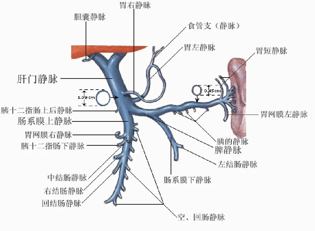 反復(fù)嘔血、黑便怎么辦？TIPS手術(shù)能解決