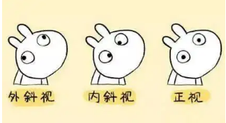 小baby老歪著頭？警惕斜頸! 這樣糾正……