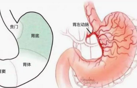 不開(kāi)刀不吃藥不餓肚子，微創(chuàng)介入減肥靠譜嗎？