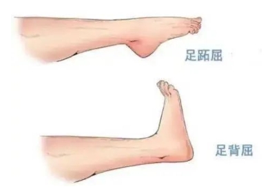 扭胯小連步、動(dòng)感搖花手……“科目三”雖火，運(yùn)動(dòng)損傷也要防！